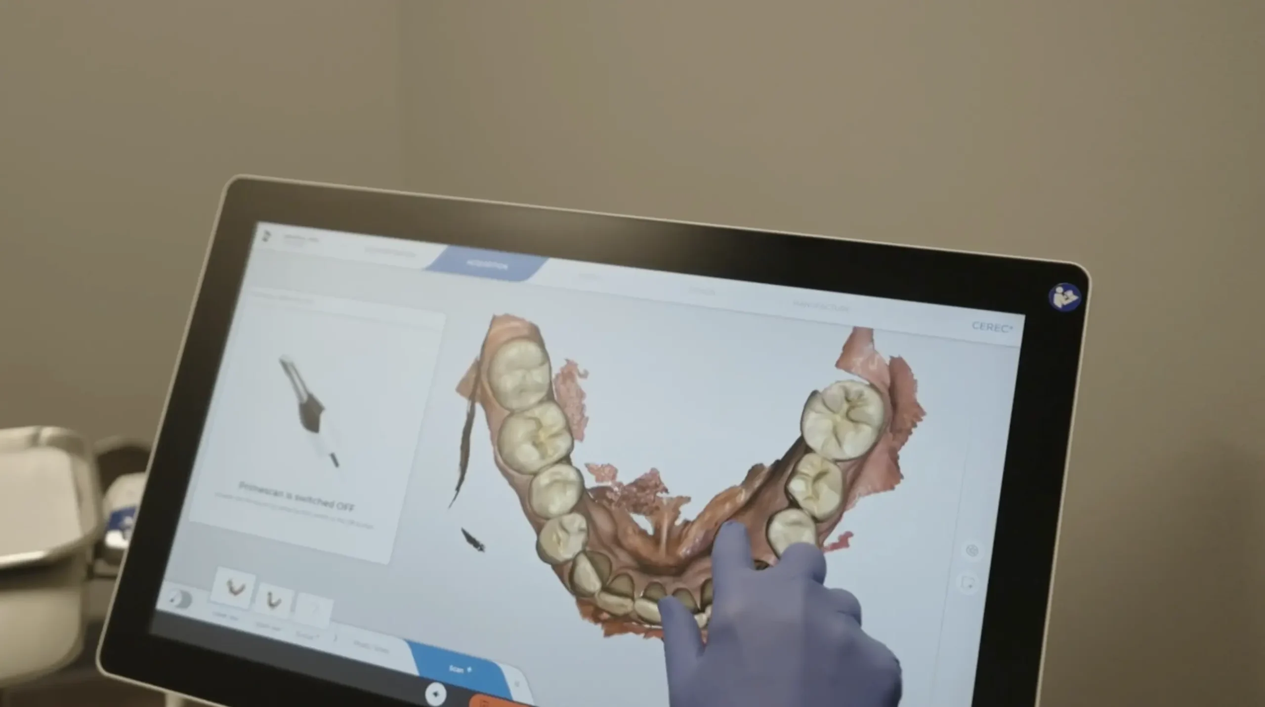 07-general dentistry-tooth-colored-fillings